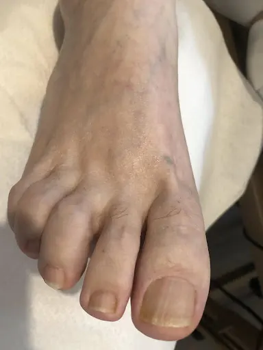 Podolog Wrocław - PodoLux – Valentyna Hrymalo